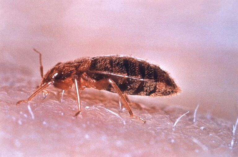 Bed Bug Bites: What They Look Like & How to Treat