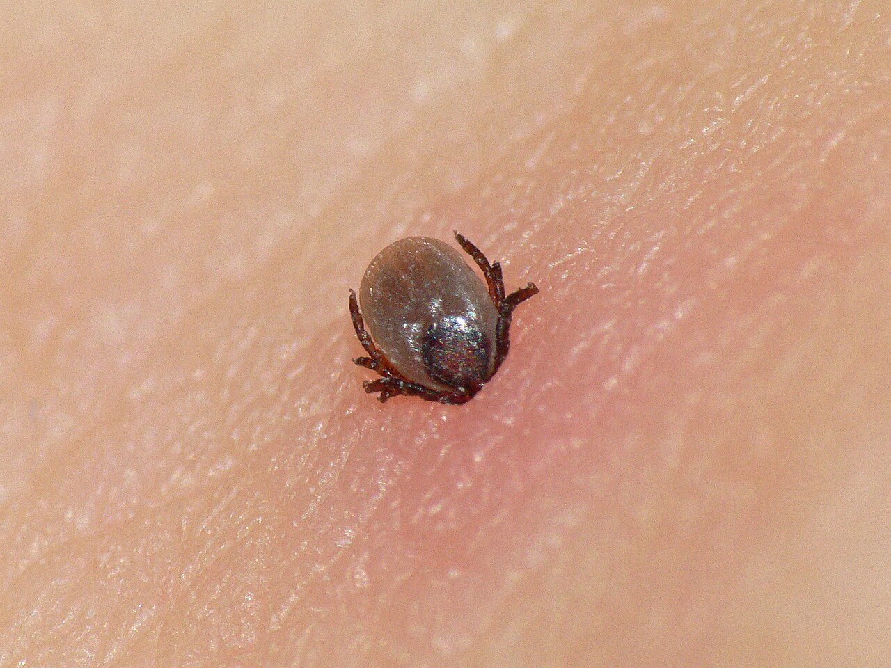 What a Tick Looks Like