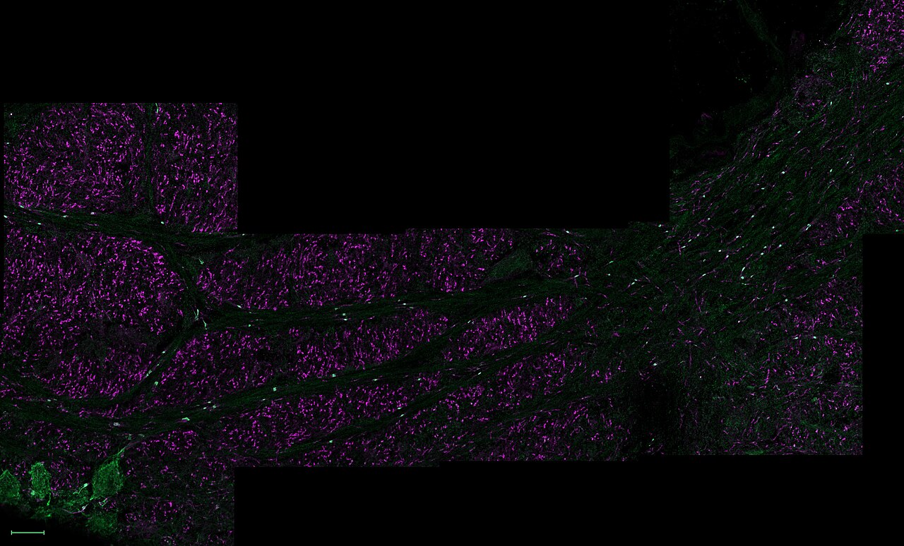 Mouse Tracks vs Rat Tracks